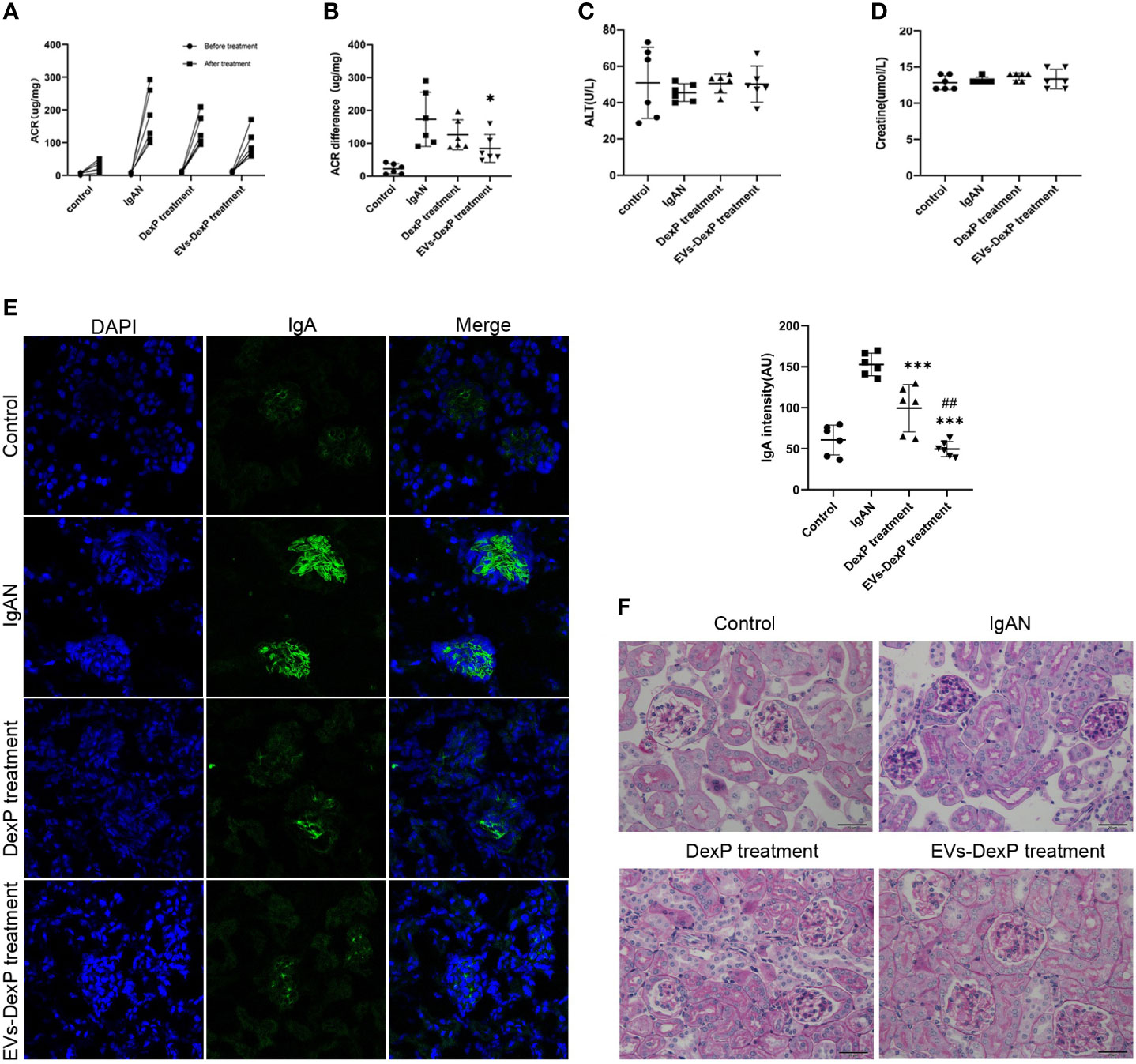 Orange exosome-encapsulated Dexamethasone treatment in IgAN mice improves kidney function and reduces IgA deposition and mesangial proliferation.